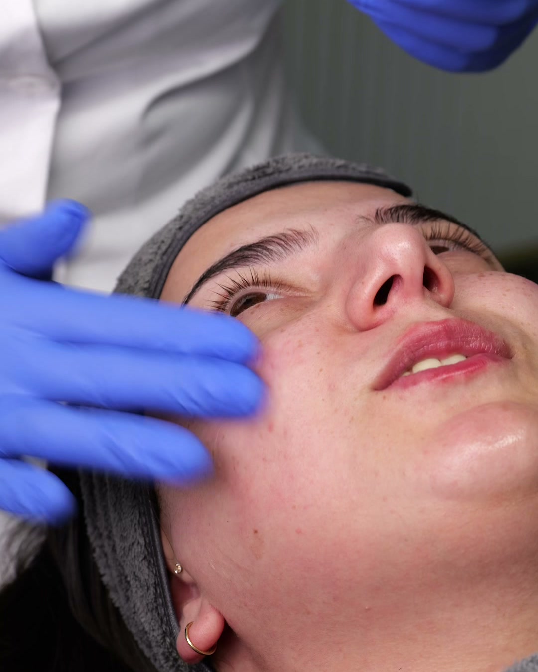 Gloved hands preparing a client's skin with a serum before microneedling