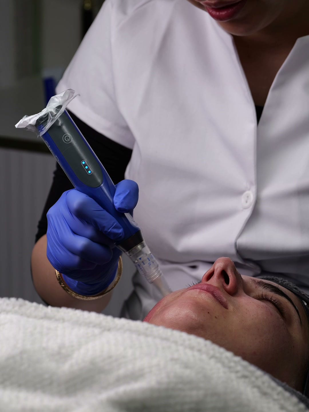 A therapist in gloves holding a microneedling pen above a client lying on the treatment couch